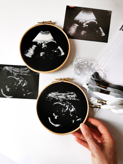 Gesticktes Ultraschallbild