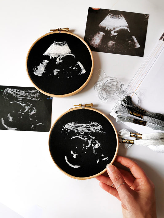 Gesticktes Ultraschallbild