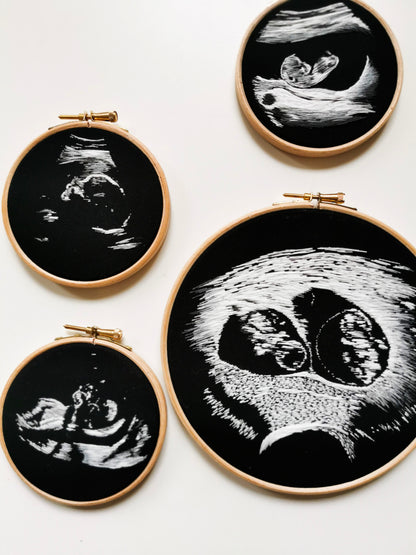 Gesticktes Ultraschallbild