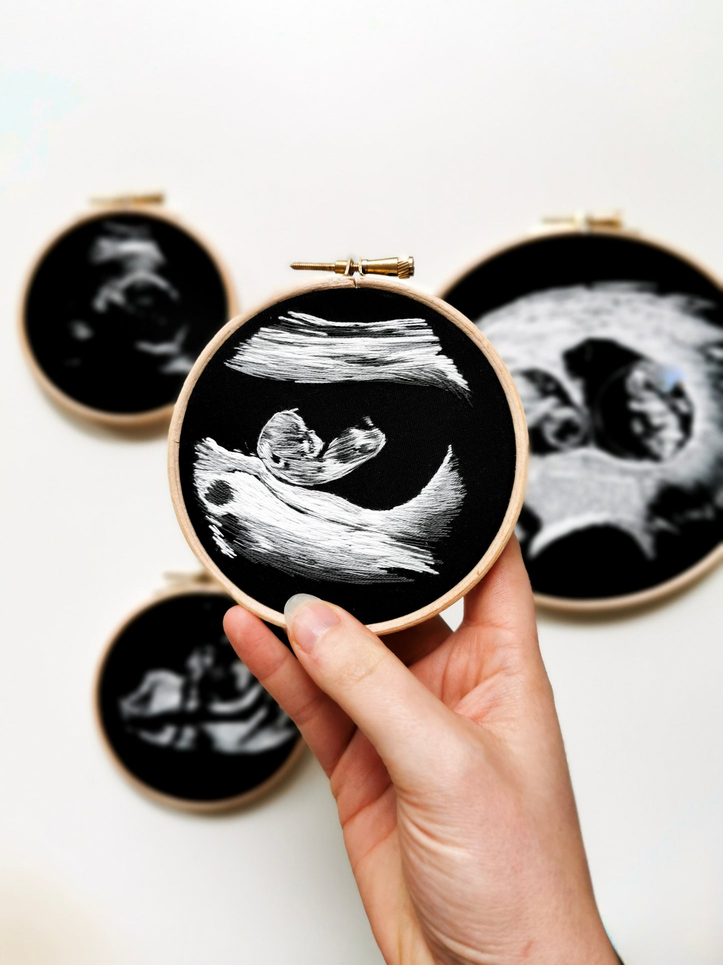 Gesticktes Ultraschallbild